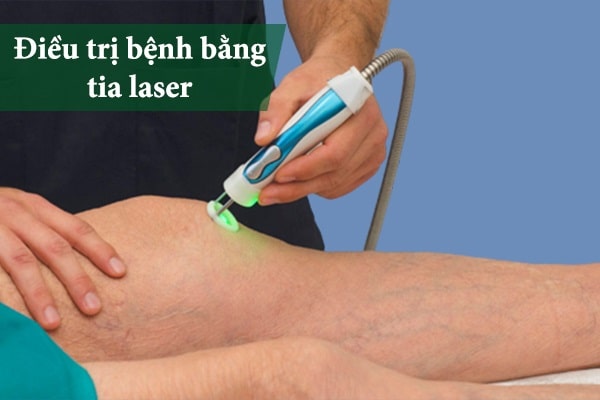 Điều trị bệnh da liễu bằng tia laser