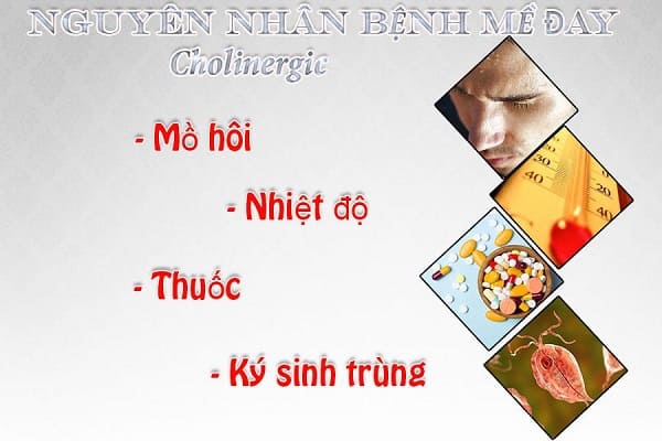 Nguyên nhân mề đay Cholinergic