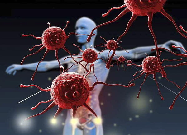 Nồng độ tế bào Lympho T thay đổi bất thường đều có khả năng gây ra các bệnh tự miễn