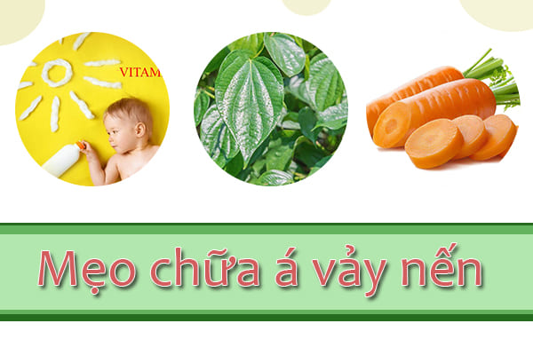 Mẹo chữa á vảy nến tại nhà