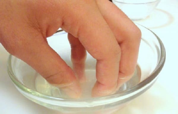 Cách điều trị vảy nến móng tay bằng giấm